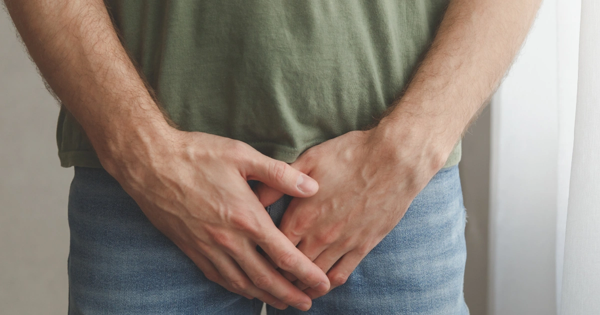 ¿Cómo eliminar verrugas genitales en hombres